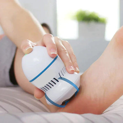 Spark and Find™ Vacuum Callus Remover